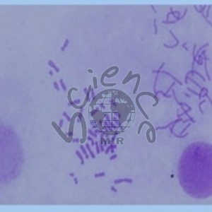 사람염색체 슬라이드 표본 사람염색체,슬라이드,표본